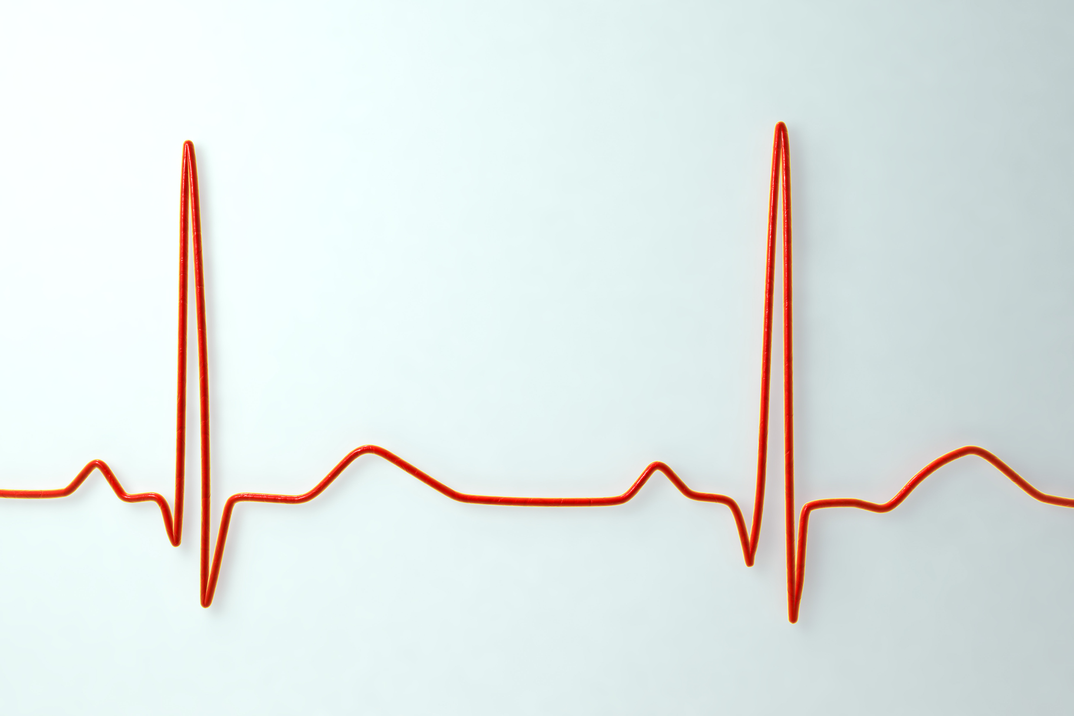 ECG. Computer illustration of an electrocardiogram (ECG) showing a normal heart rate.
