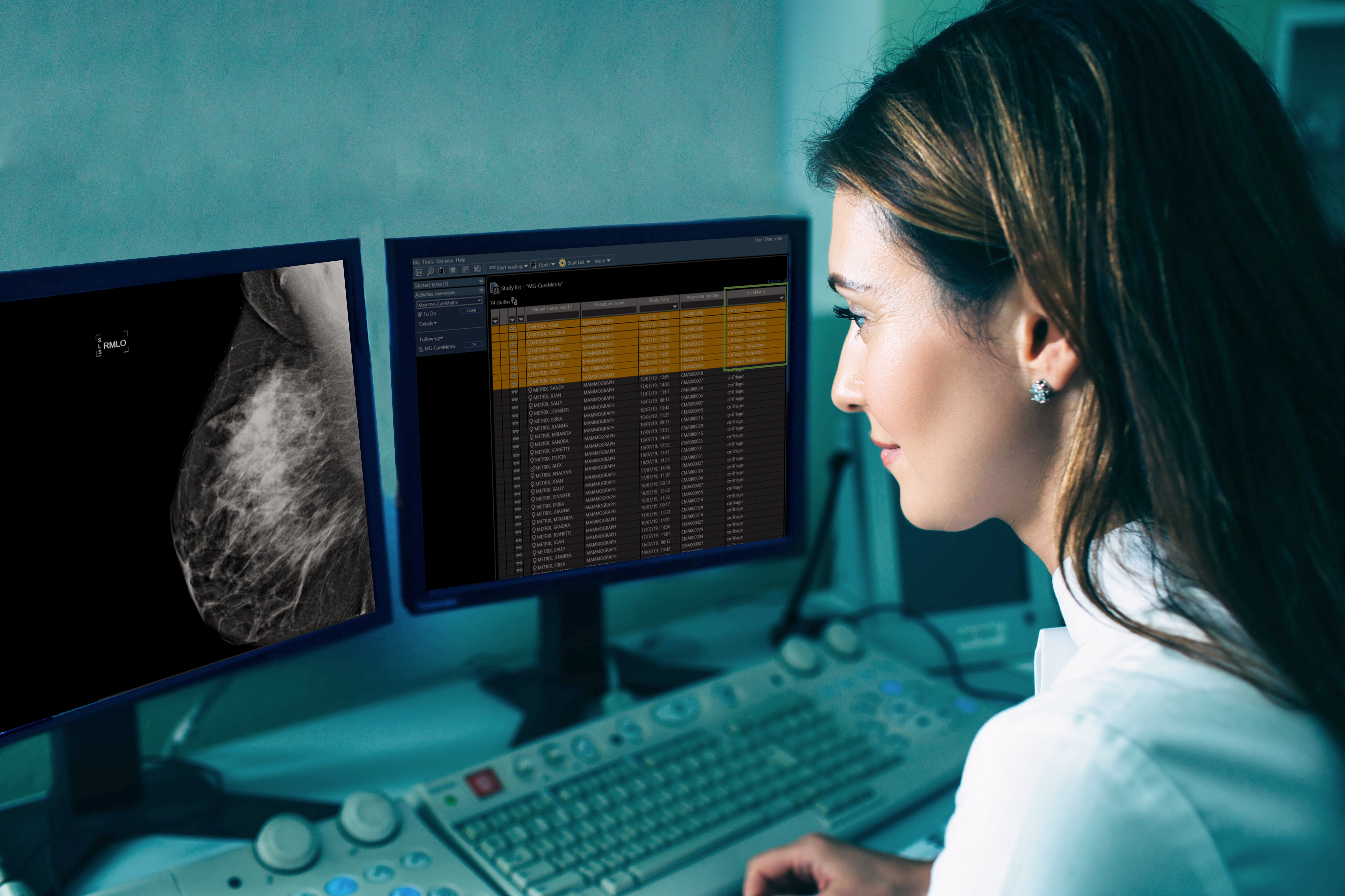 CureMetrix artificial intelligence aids radiologist in improving breast cancer detection

